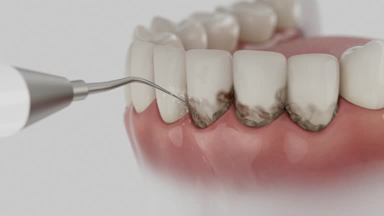 Trusted Root Canal Treatment service in Harrisburg, AR - Dentist Open Now